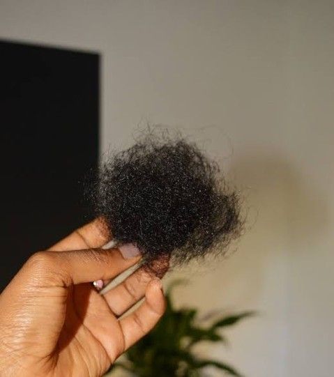 Alopécie de traction : comment la prévenir et la traiter ?