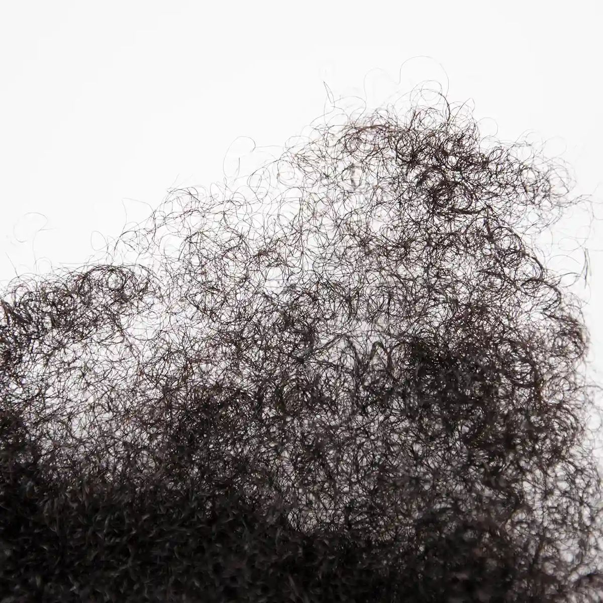 Alopécie : Comprendre les causes et trouver des solutions